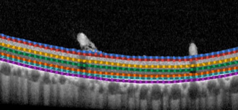 Retina at pixel scale